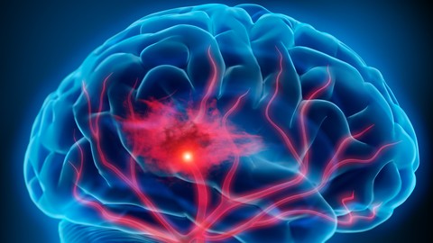 Why Stroke Matters: Neurology for Non-Neurologists