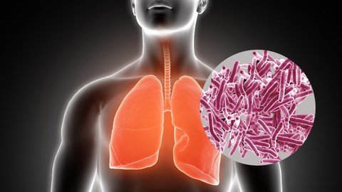 Microbiology: All about Tuberculosis (TB)