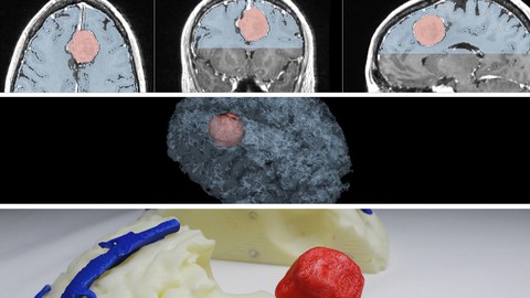 Medical Imaging, 3D Modelling and 3D Printing - Beginners