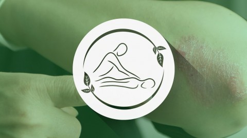 Recover Now - A Project for Naturally Healing your Psoriasis