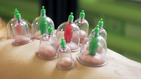 Advance Hijama Cupping Therapy Course