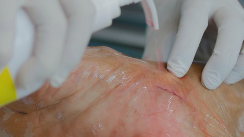 Clean Your Wound Correctly