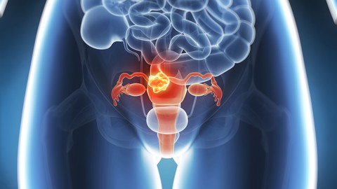 Natural Protocols for Cervical, Ovarian, Endometrial Cancers