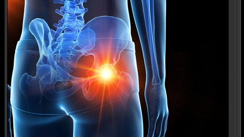 Hip Pain: Causes and Differential Diagnosis