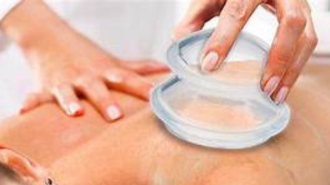 Cupping Massage Therapy