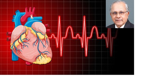 Cardiac Arrhythmias Part 2
