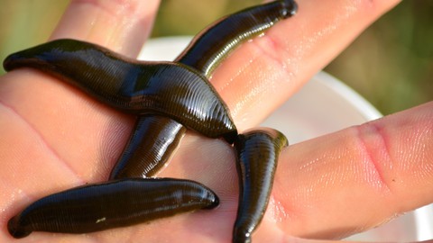 Medicinal Leech Therapy : New Life for an Ancient Treatment