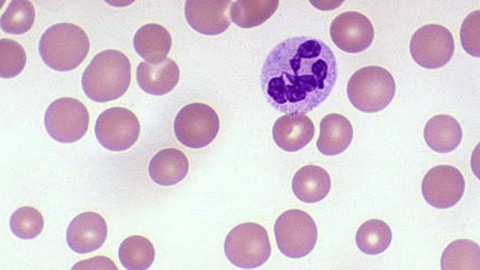 Haematology : Megaloblastic Anemia