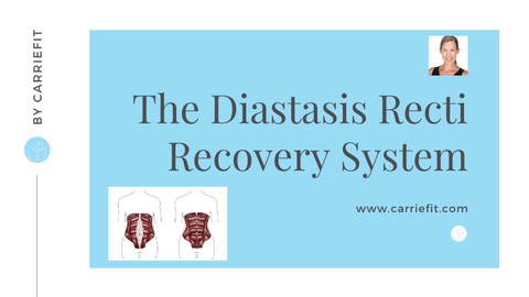 Diastasis Recti Recovery System