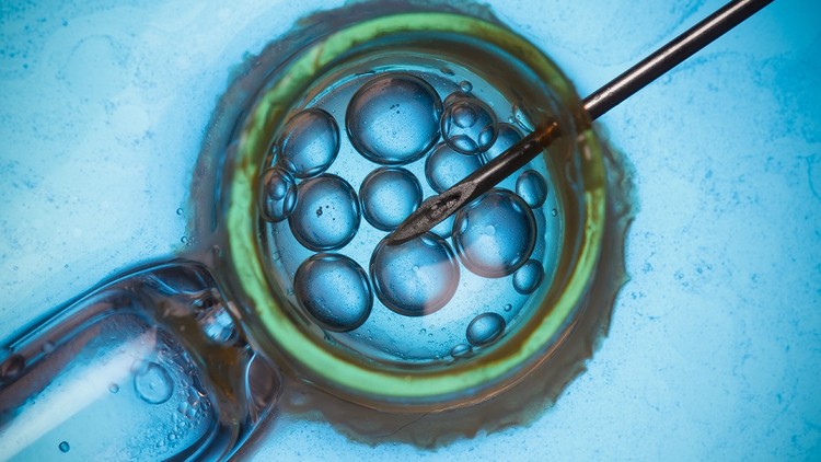 Everything you need to know before starting your IVF or ART